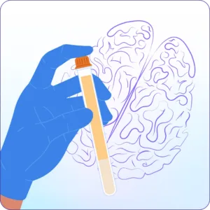 Ultrasensitive Detection of Alzheimer’s Disease Biomarkers in Blood